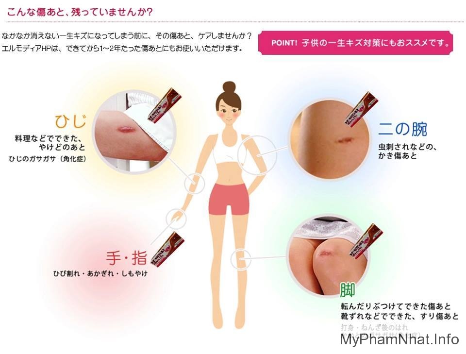 Kem trị sẹo Kobayashi Nhật (15g) 