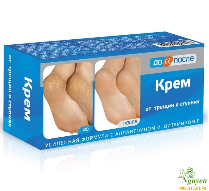 Kem trị nứt gót chân Nga